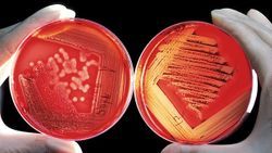 Microbial Identification by MALDI-TOF: Moving from Colonies to Blood Cultures and Biofilms