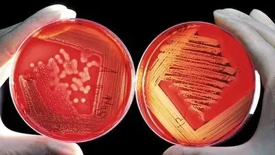Microbial Identification by MALDI-TOF: Moving from Colonies to