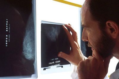 New Study Supports Mammography Screening at 30 for Some Women
