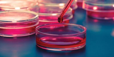 Clinical Microbiology Meets Total Laboratory Automation