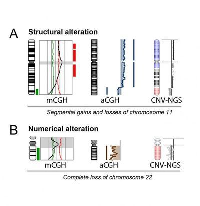 Double Factor Preimplantation Genetic Testing Now Possible Through Massive Sequencing Techniques