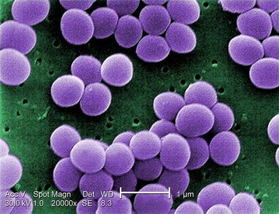 Multicenter Trial Supports Use of Topical Antibiotics in NICU Babies
