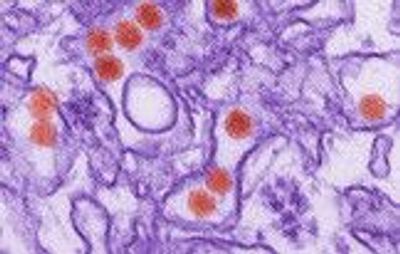 Zika and Chikungunya Viruses: Diagnostic Pitfalls