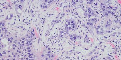 How Whole Slide Imaging is Changing the Role of the Pathologist