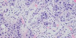 How Whole Slide Imaging is Changing the Role of the Pathologist