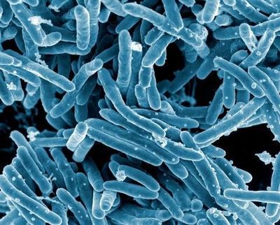 The Need for Speed in Tuberculosis Diagnostics