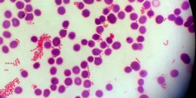 A Closer Look at Multiplex Panels for Respiratory, Gastrointestinal, and Blood Pathogens