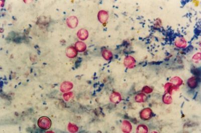 Diagnostic Tool for Detecting Cryptosporidium