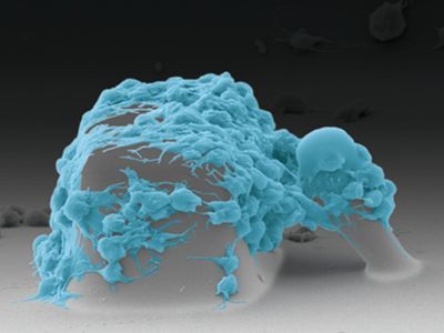 New Method to Assess Platelet Health