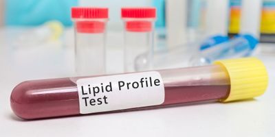 Blood Lipid Profile Test to Predict Diabetes