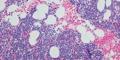 Mylenoma