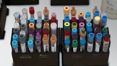 Tube-versatile Lab Automation Drives Future Readiness