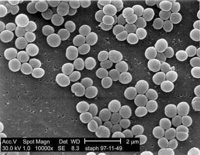 Why Isn&#39;t There a Vaccine for Staph?