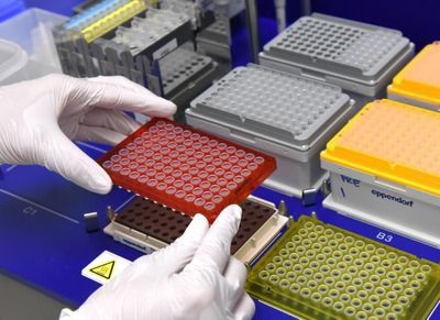 whole exome sequencing