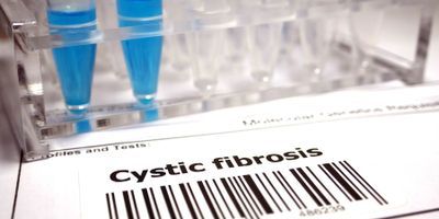 Genetic Testing for Cystic Fibrosis