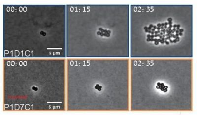 MRSA bacteria under a microscope