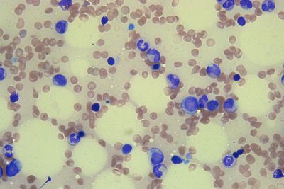 healthy bone marrow