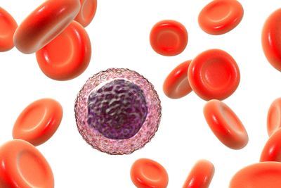 Low Lymphocyte Count May Indicate Increased Mortality Risk