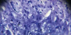 heart cells