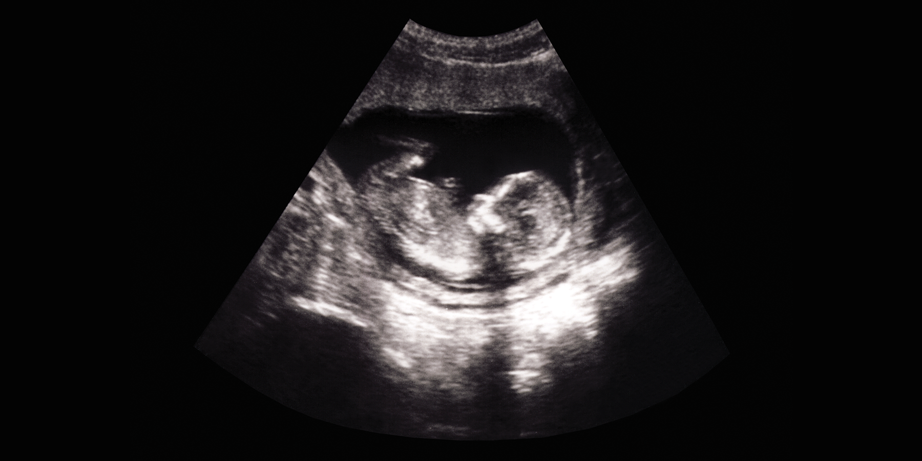 Human Fetus Ultrasound
