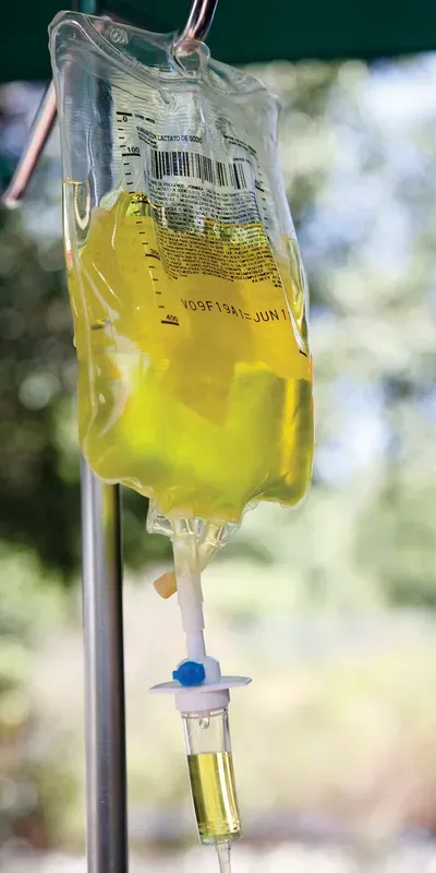 Vitamin C IV Drip