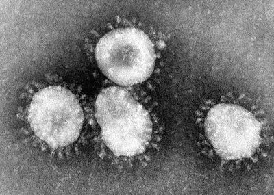 Coronavirus: New Report Provides Largest Clinical and Treatment Data Set