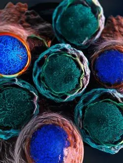Graphic Leukemia Cells in the Course of Therapy