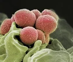 Group A Strep