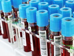 How to Implement Automation in the Lab