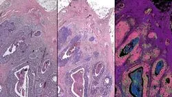 Infrared-Optical Hybrid Microscope