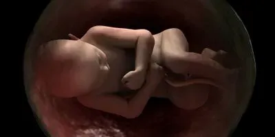 Fetus, 40 weeks