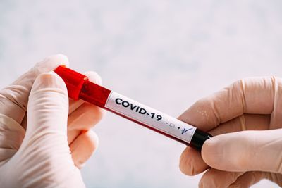 Handling Potential COVID-19 Specimens