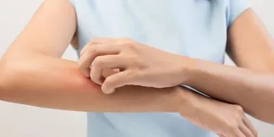 Allergic Reaction