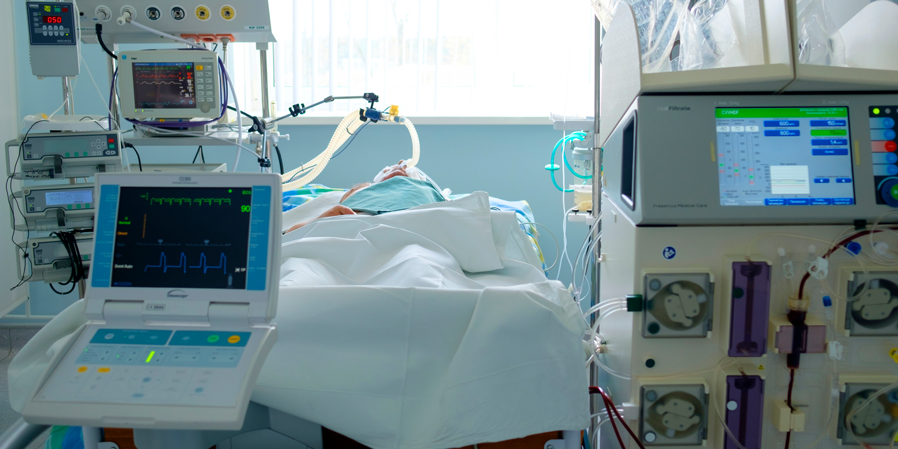Patient in ICU