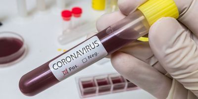 Coronavirus Test Concept Image
