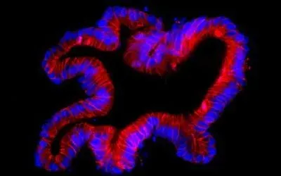 human colon organoid