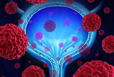 Applications of FISH in Cancer Cytogenetics