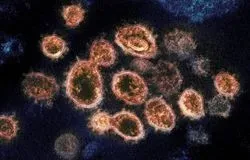SARS-CoV-2 Virus