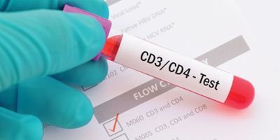 Fluorescence-Activated Cell Sorting for Cell-Based Therapies