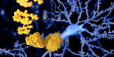 amyloid protein in the brain