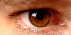 Damaged Eye