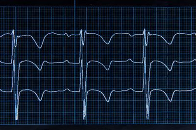 Cardiac Biomarkers for Diagnosis, Prognosis, and Therapy Guidance