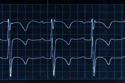 Cardiac Biomarkers for Diagnosis, Prognosis, and Therapy Guidance