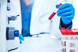 Liquid Biopsy