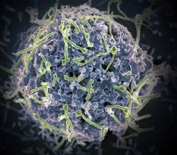 Ebola virus