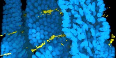 Cholera Colonization of Intestine