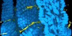 Cholera Colonization of Intestine