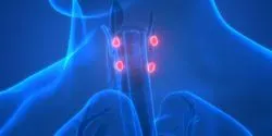 throat cancer concept