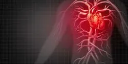 Heart Disease Illustration