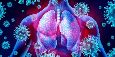 using AI to assess COVID-19 patients